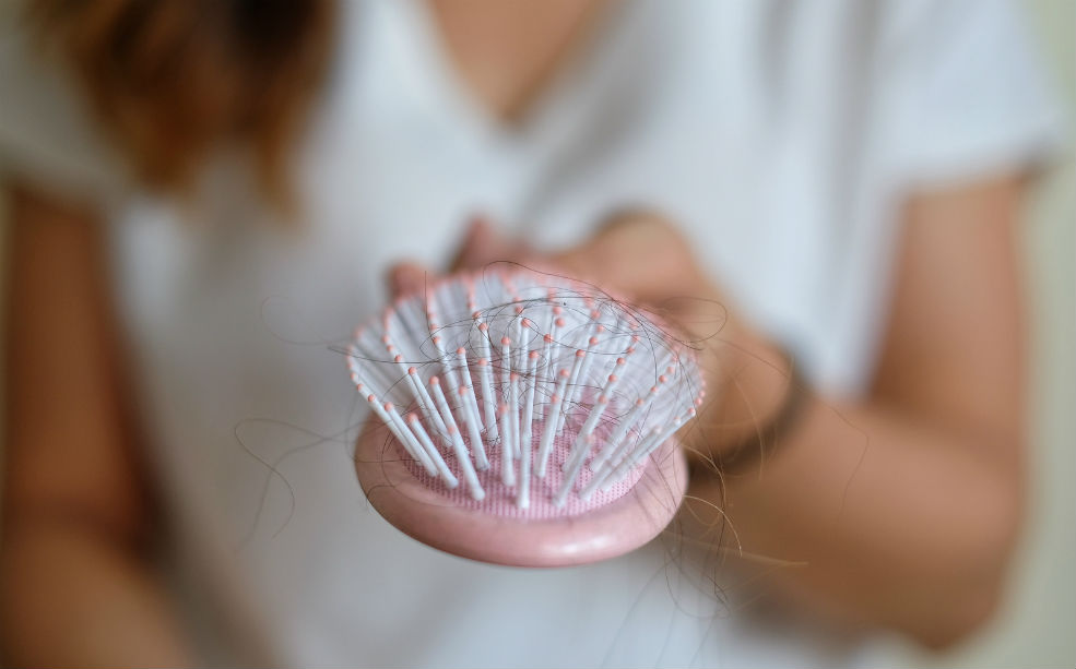 Alopecia: cepillo con cabello por caída capilar