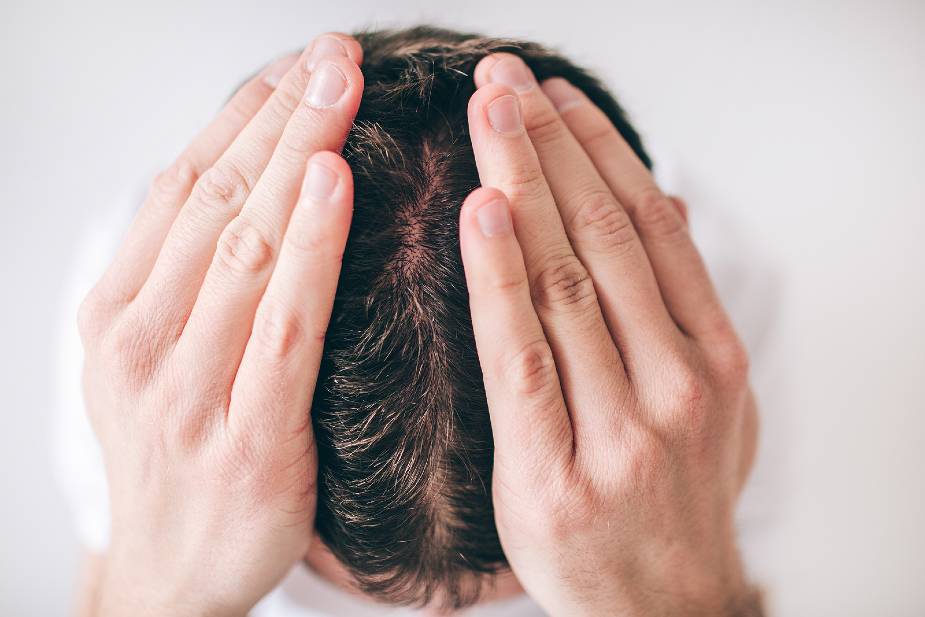 Hombre con ambas manos en la cabeza y pelo fino