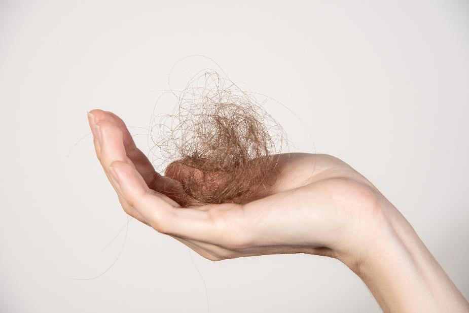 Mujer sosteniendo una caída del pelo por medicamentos