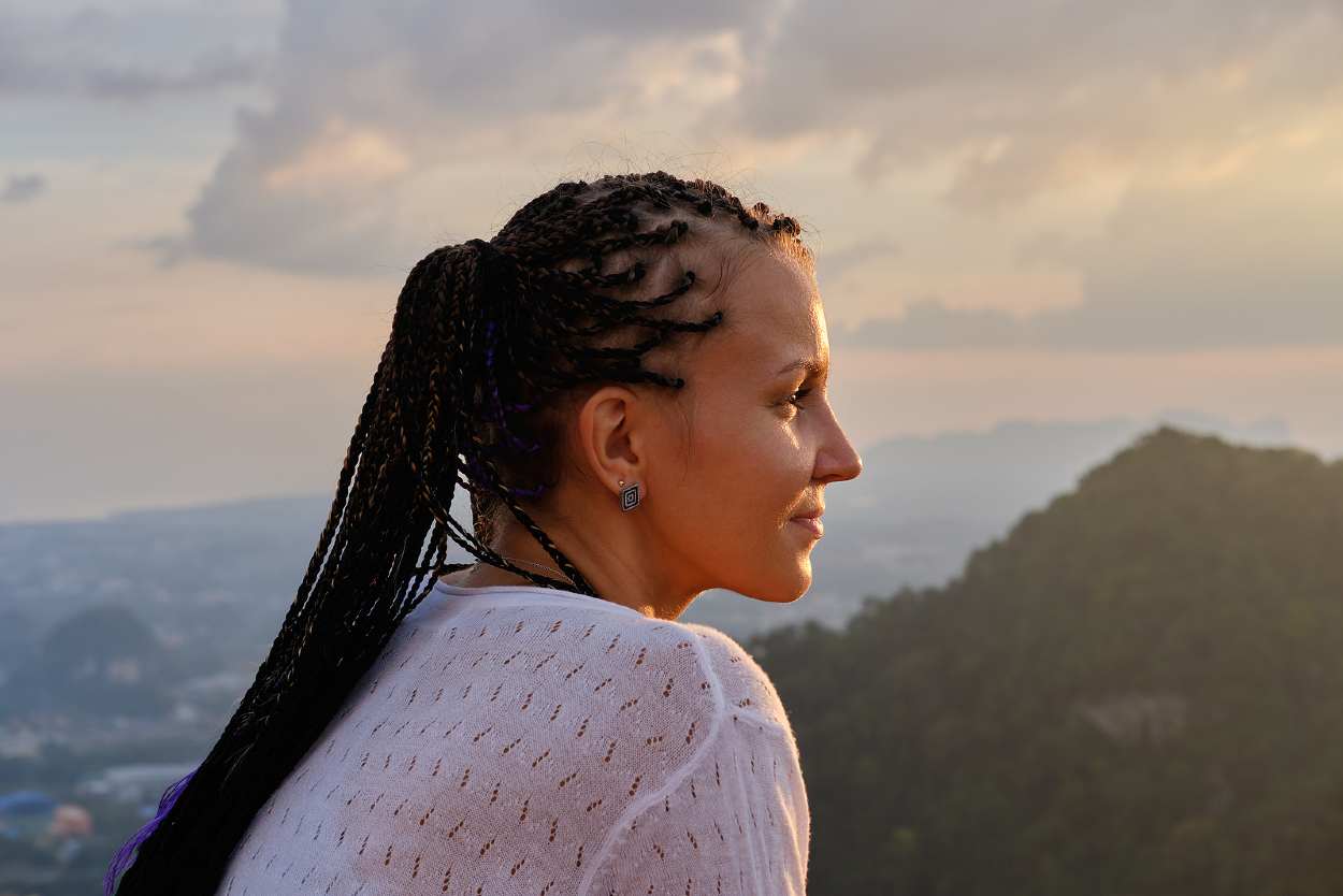 Alopecia por tracción en mujer con trenzas