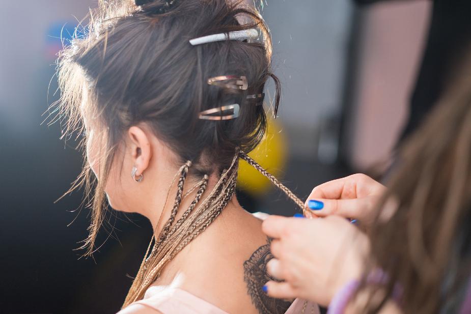 Mujer con alopecia por tracción a causa de extensiones y trenzas.