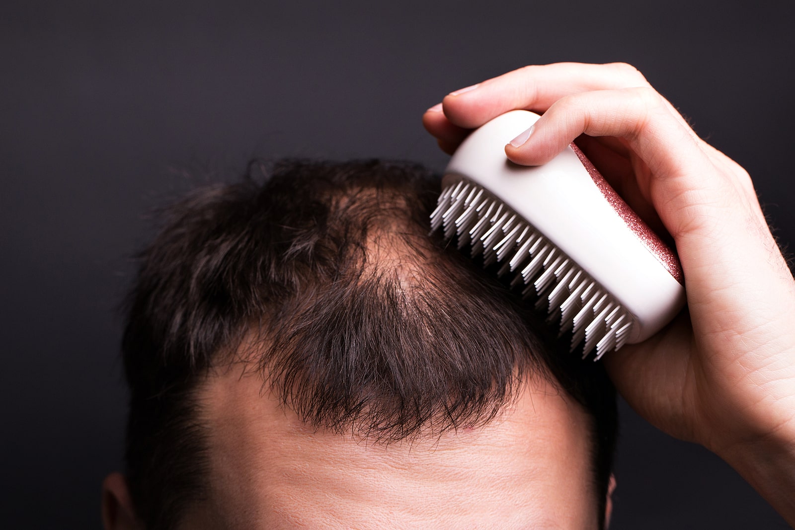 Hombre con el pelo fino se peina