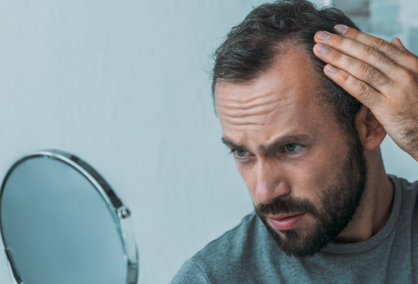 Hombre se mira al espejo por tener entradas en el pelo