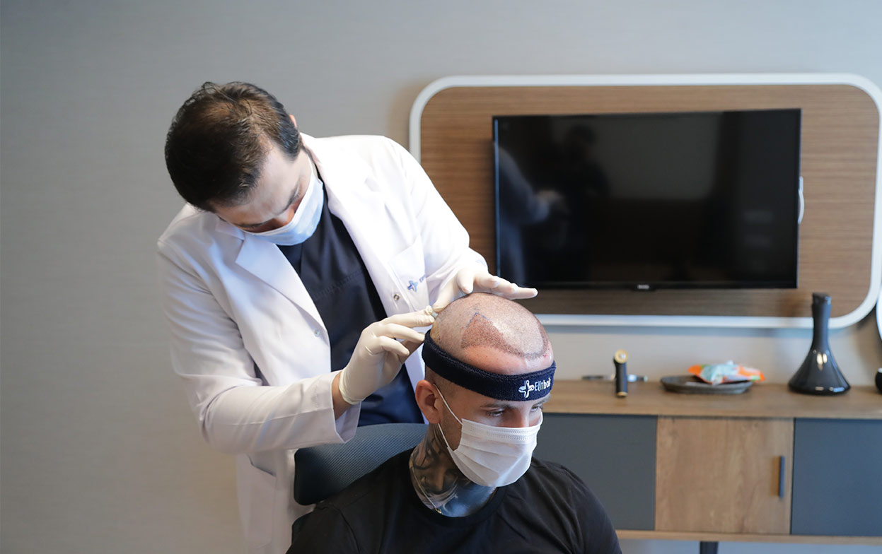 El Dr. Balwi durante el examen postoperatorio con un paciente de injerto capilar en Elithair