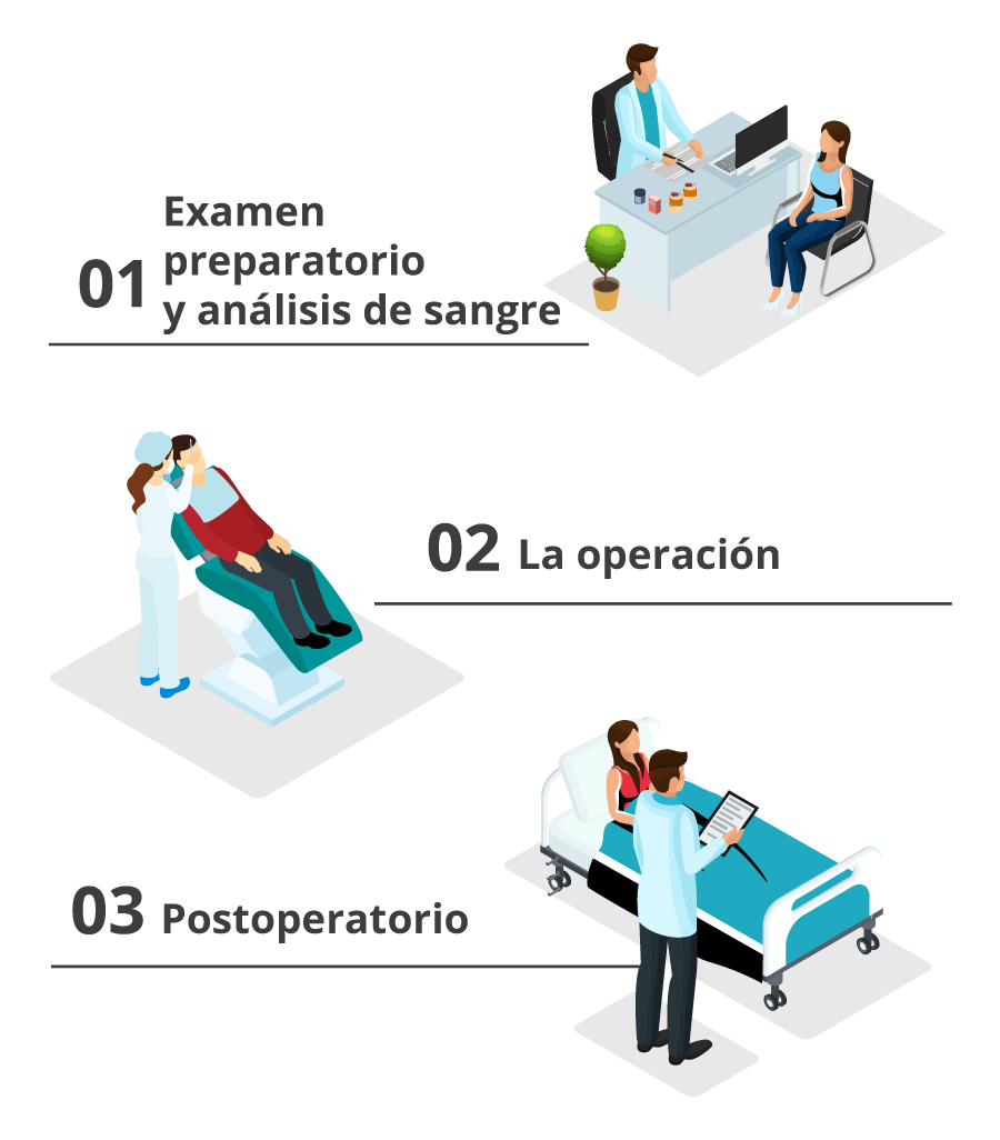 Ilustración en 3 pasos del procedimiento de trasplante capilar en Estambul