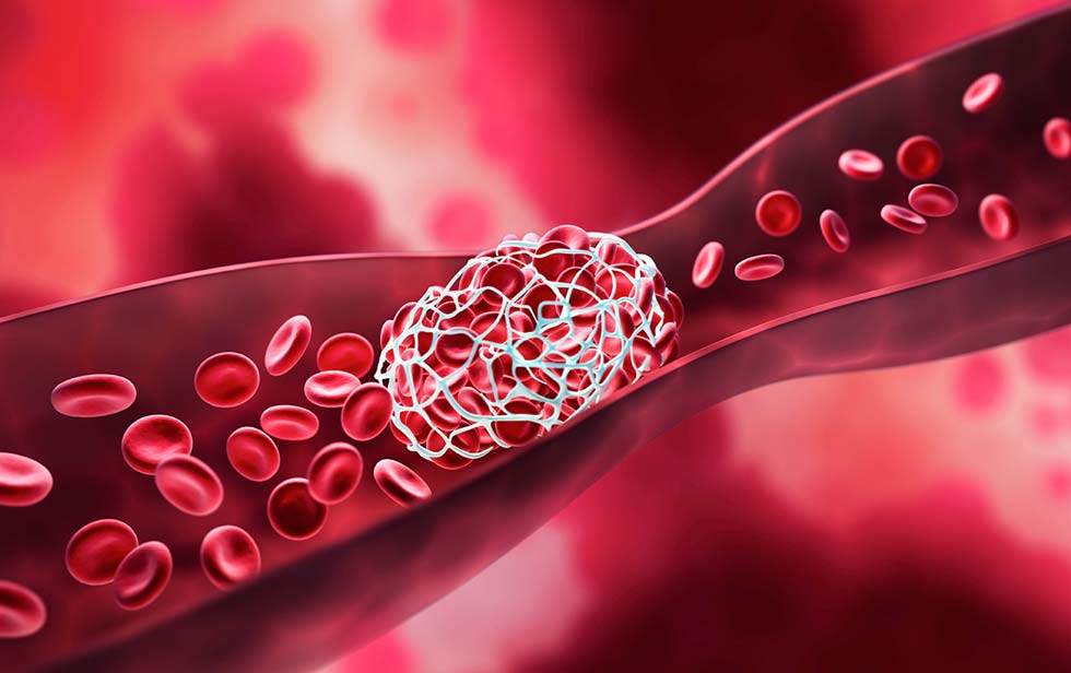 Ecografía Doppler para medir la circulación de la sangre y los glóbulos rojos