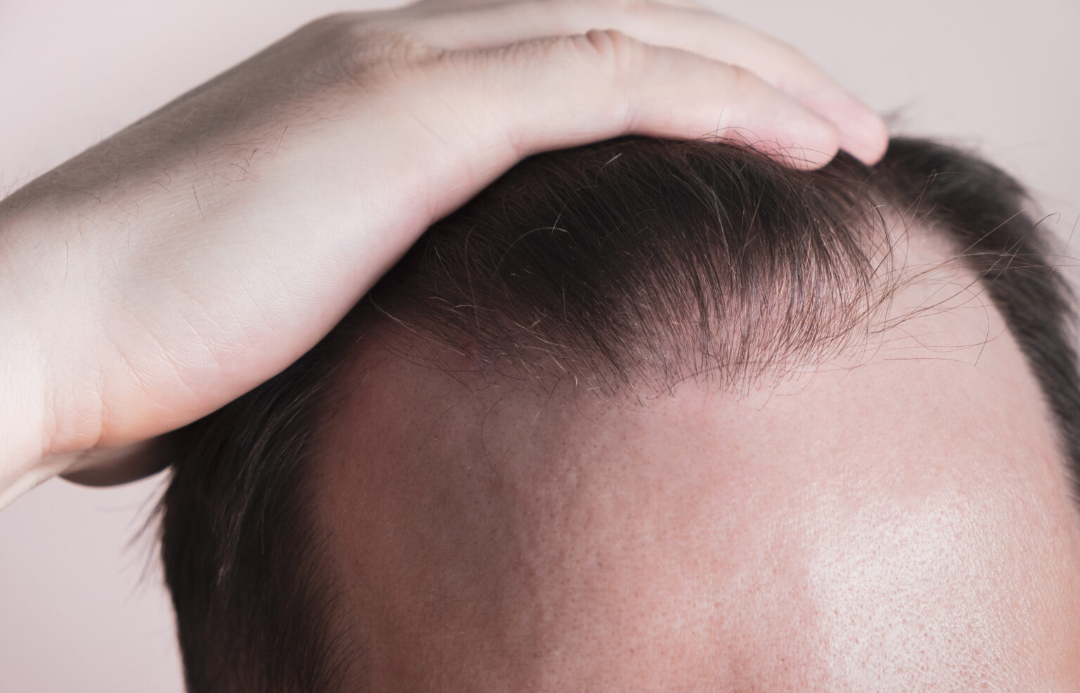 Tratamientos contra la alopecia en 2023