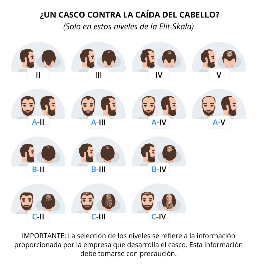 Infográfica muestra los niveles de la Elit-Skala aptos para el casco contra la alopecia.