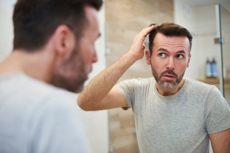 Hombre se toca y mira el pelo en el espejo para comprobar los efectos de la caída del cabello.