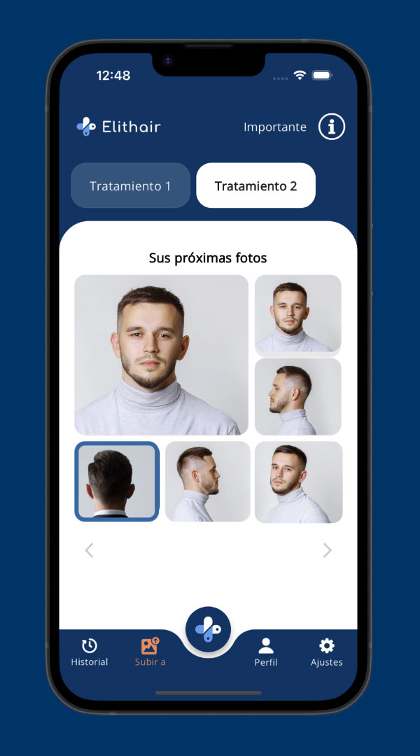 Sube tus fotos cada mes para controlar el crecimiento de tu cabello con la App Elithair