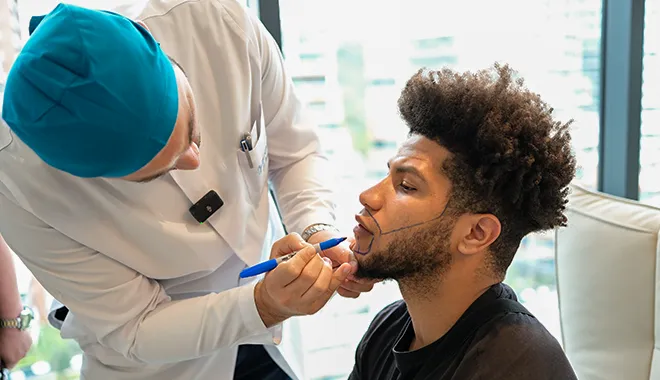 El Dr. Balwi diseñando el trasplante de barba de un paciente en la clínica Elithair. La imagen muestra al doctor trazando la línea de la barba para definir la forma y distribución ideales antes de la implantación.